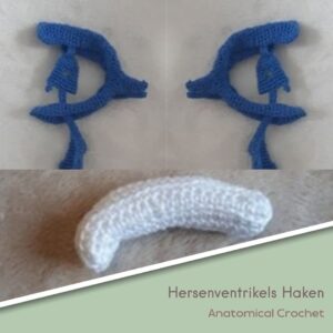 Hersenventrikels Haken