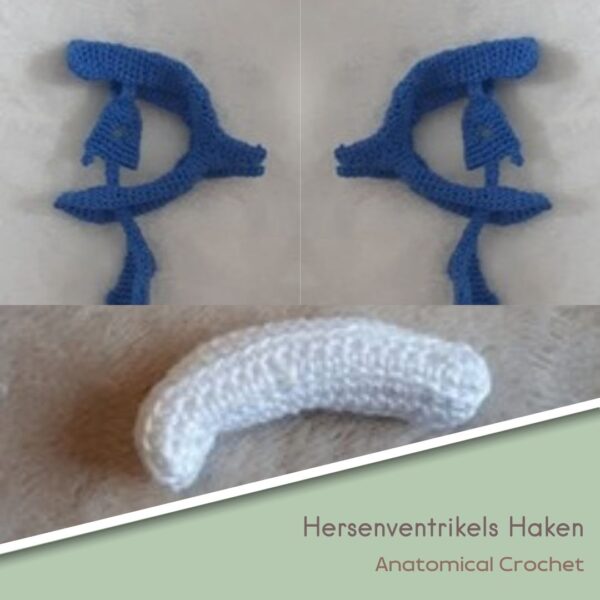 Hersenventrikels Haken